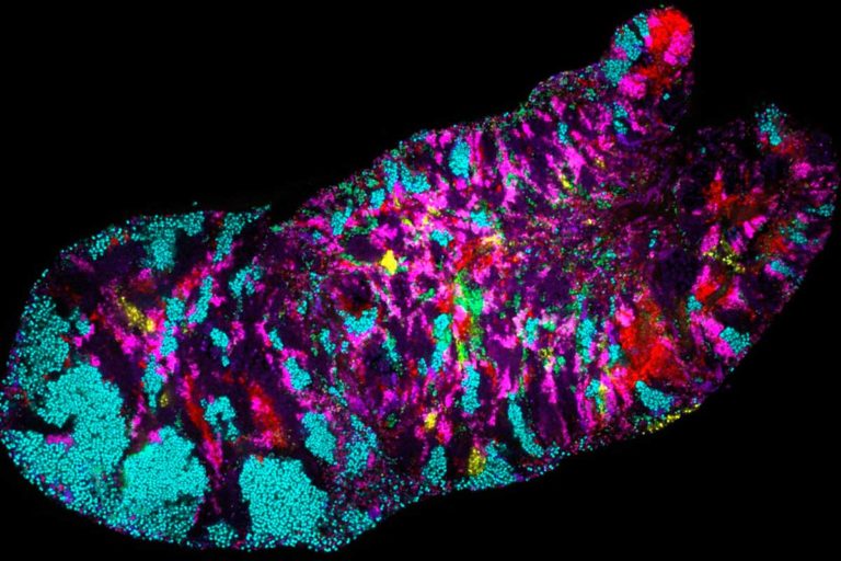 Micrografía con células de Rothia (azul claro) en su hábitat nativo, una biopelícula bacteriana raspada de lengua humana (FOTO Jessica Mark Welch, Marine Biological Laboratory)