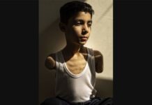 Un niño palestino mutilado durante un ataque israelí: la imagen del año en el concurso World Press Photo “Mahmoud Ajjour, Aged Nine”; Samar Abu Elouf (‘The New York Times’)